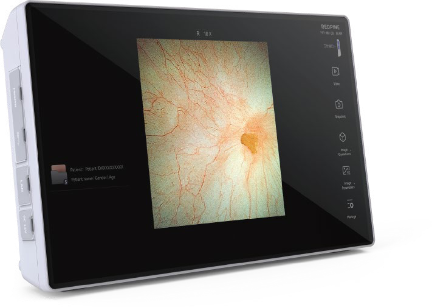Image Processor V1000